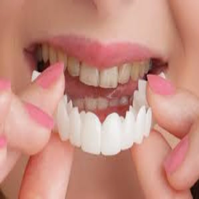 Snap on Dental Smile-Best Quality